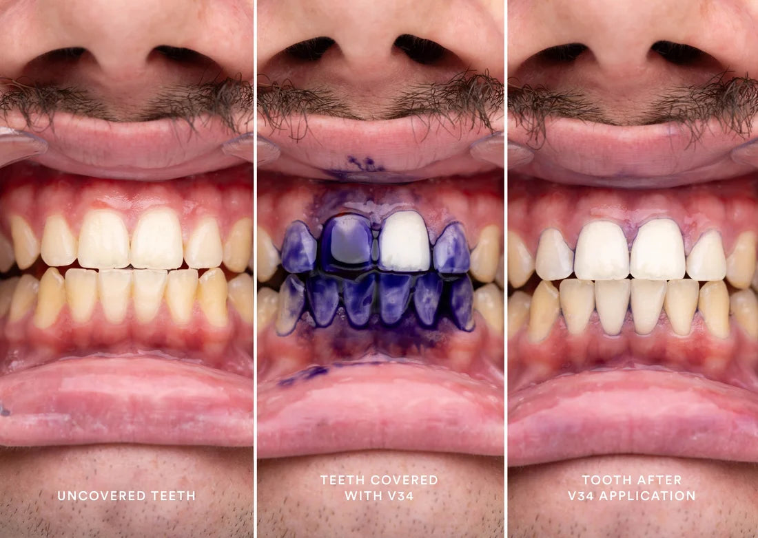 VioletBright: Teeth Whitening Serum