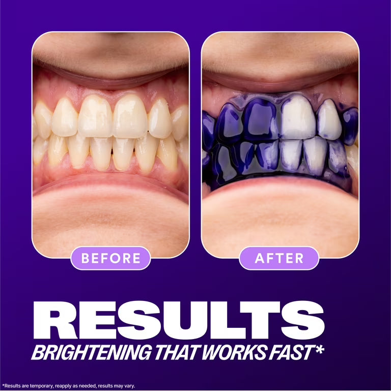 VioletBright: Teeth Whitening Serum